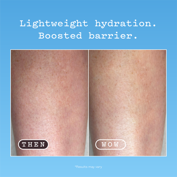 Hyaluronic Acid Body Serum before and after, headed Lightweight hydration. Boosted barrier. Left panel labelled THEN is the before: dry, reddened skin on the thigh. Right panel labelled WOW is the after: the same thigh looking calmer and hydrated. Results may vary.