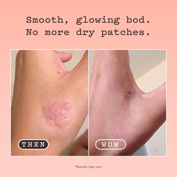 Before-and-after comparison showing a human hand with a dry, irritated patch labeled 'THEN' on the left and a smooth, glowing hand labeled 'WOW' on the right, under the text 'Smooth, glowing bod. No more dry patches.