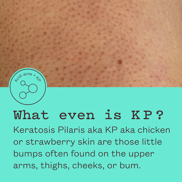 Glycolic Body Scrub